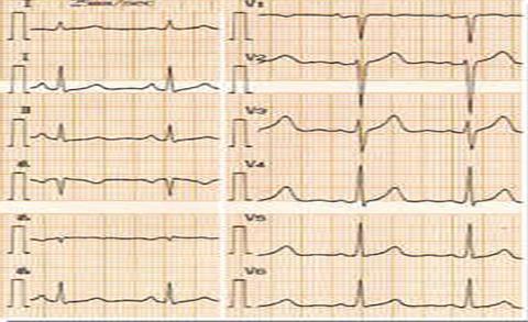 �t(y��)����ԇ��늈D