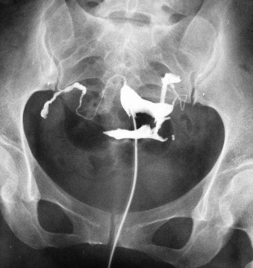 �ӌmݔ�ѹ���Ӱ