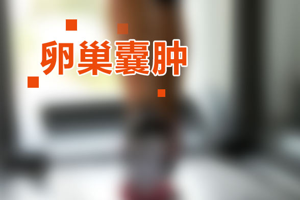 非腫瘤性卵巢囊腫是什么？非腫瘤性卵巢囊腫有哪些癥狀？