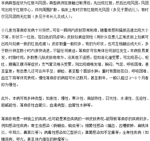 小兒蕁麻疹的臨床表現(xiàn)有哪些？