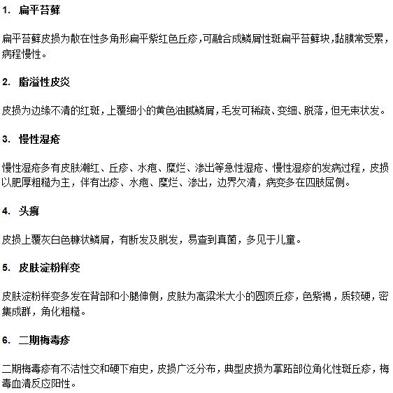 牛皮癬需要與以下疾病進行鑒別診斷