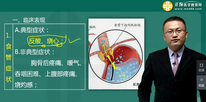 胃食管反流?。℅ERD）的藥物治療方法-消化系統(tǒng)高頻考點(diǎn)