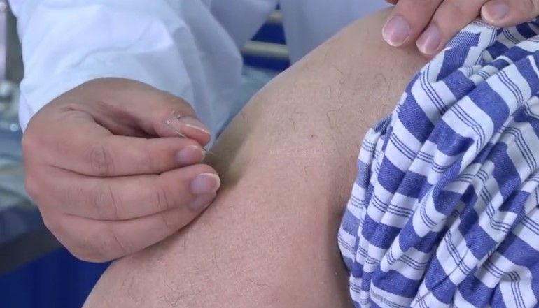 刺針補(bǔ)瀉 刺針補(bǔ)瀉