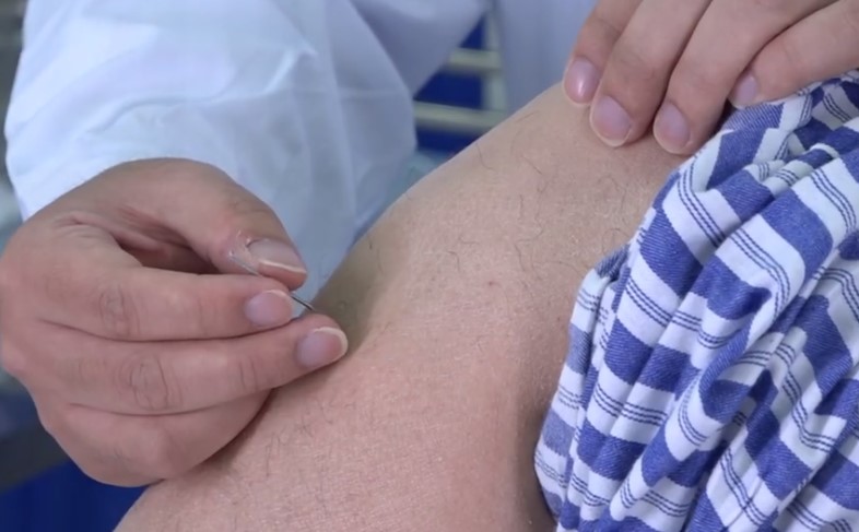 提插補(bǔ)瀉 提插補(bǔ)瀉