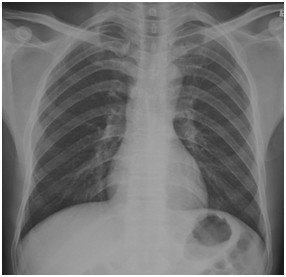 影像診斷模擬試題2 影像診斷模擬試題2