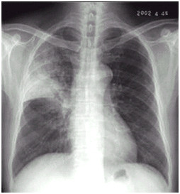 影像診斷1 影像診斷1