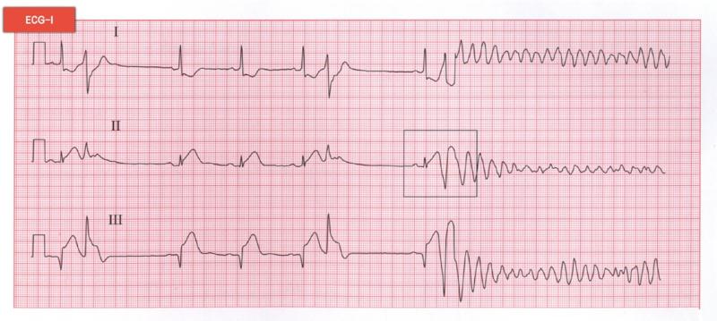 臨床技能模擬卷題8 臨床技能模擬卷題8