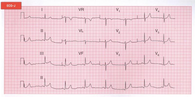 臨床技能模擬卷題9 臨床技能模擬卷題9