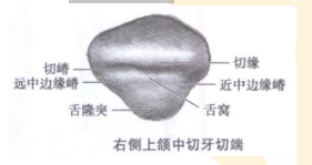 切端的各個結(jié)構(gòu) 切端的各個結(jié)構(gòu)