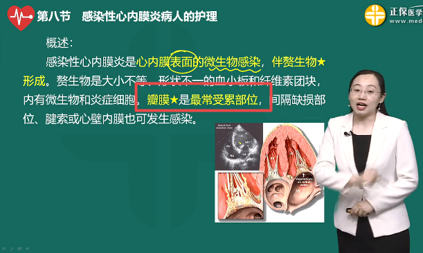 感染性心內(nèi)膜炎最常受累部位 感染性心內(nèi)膜炎最常受累部位
