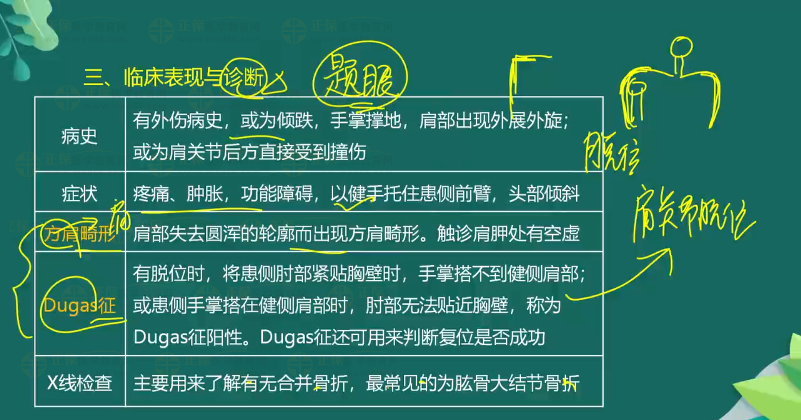 關節(jié)脫位-顳下頜關節(jié)脫位、肩關節(jié)脫位知識點總結-3