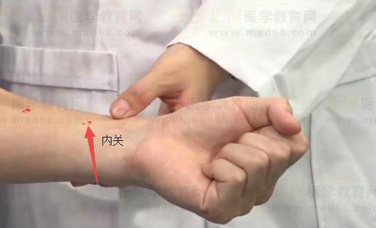 內(nèi)關 內(nèi)關