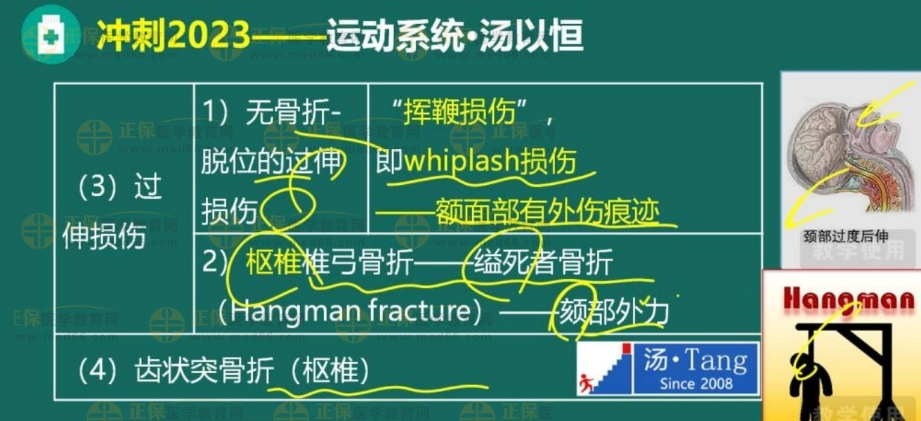 頸椎骨折2 頸椎骨折2