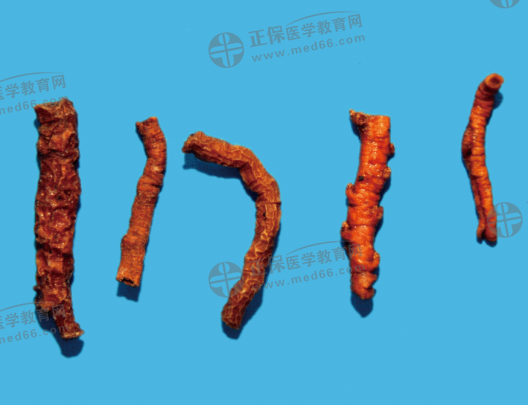 遠(yuǎn)志 遠(yuǎn)志