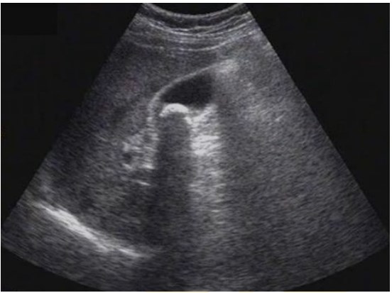 影響診斷 影響診斷